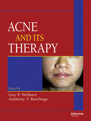 cover image of Acne and Its Therapy